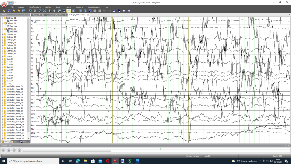Wykres EEG